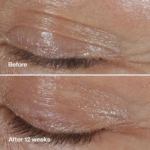 Косметичний засіб Clinique Smart Clinical Repair Wrinkle Correcting Eye Cream, 15 мл КОСМ02098 фото