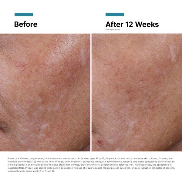 Косметичний засіб SkinCeuticals HA Intensifier Multi-Glycan, 30 мл КОСМ00148 фото