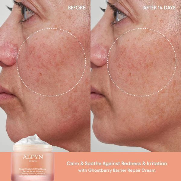Косметичний засіб Alpyn Beauty Super Peptide and Ghostberry Barrier Repair Cream, 50 мл КОСМ01548 фото